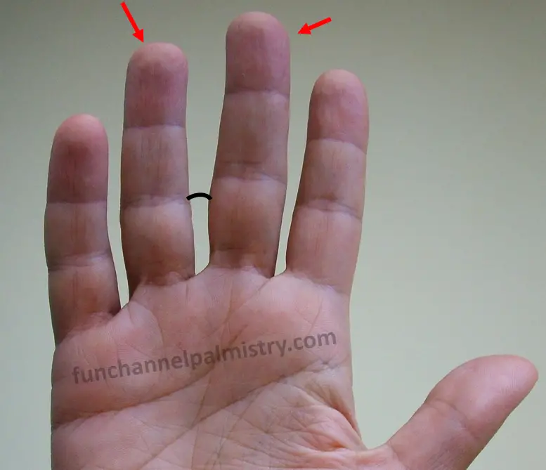 gap between middle and ring finger