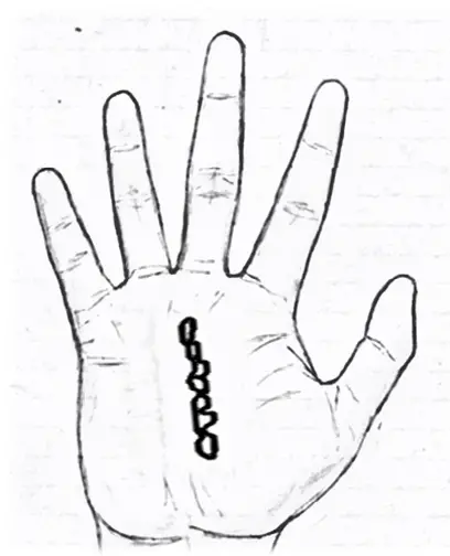 Chained line in palmistry