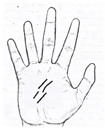 Breaks on the line in palmistry