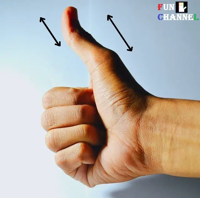 Second phalange of the thumb is greater than the first phalange of the thumb
