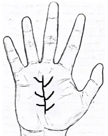 Tree Sign in palmistry