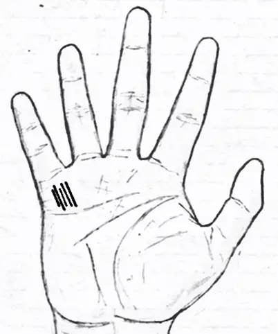 medical stigmata in palmistry