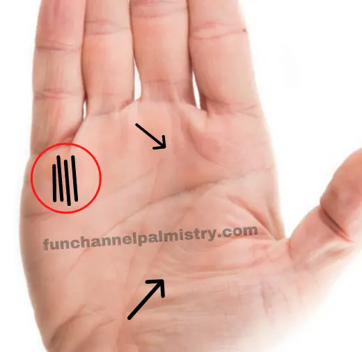 Medical Stigmata lines in Palmistry