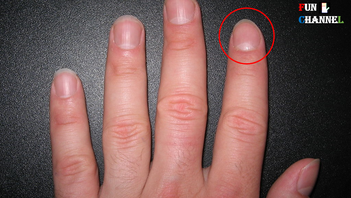 Do You Have Half Moon Shape On Your Nails?-Palmistry