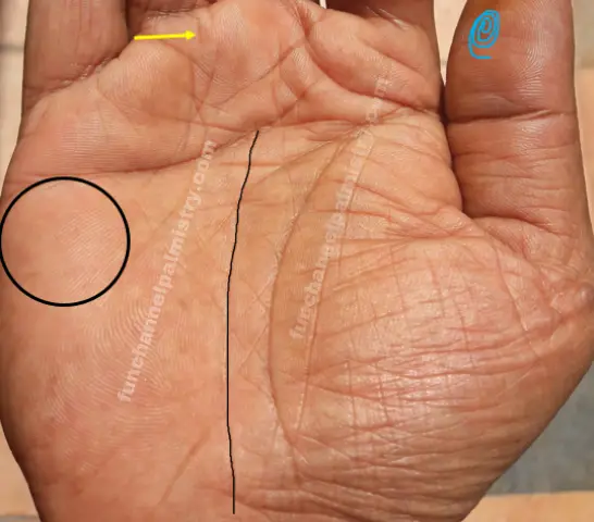 Whorl on thumb in palmistry