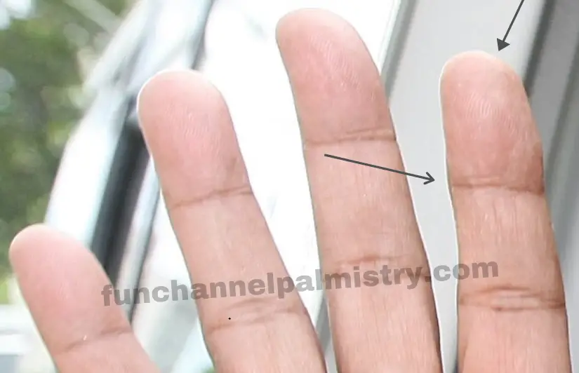 Whorl on index finger