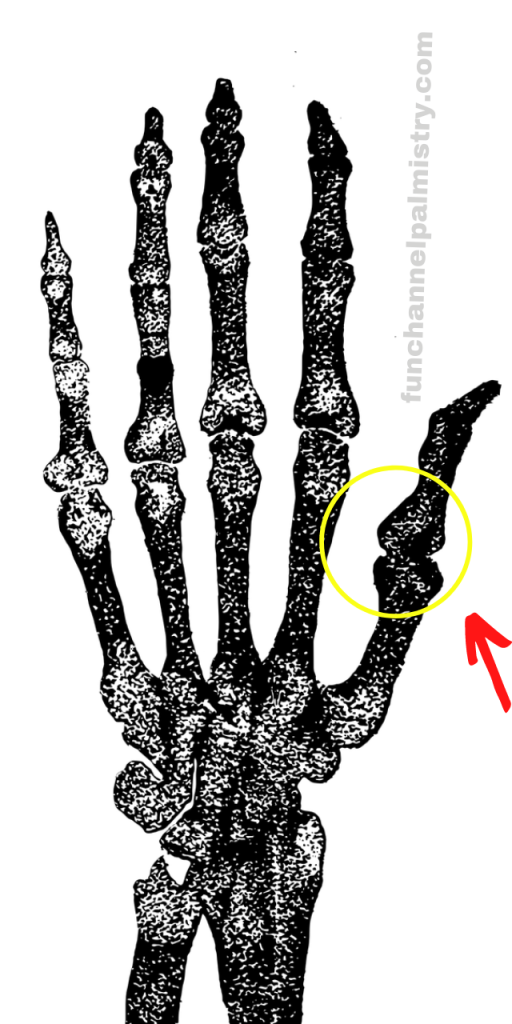 Thumb joints
