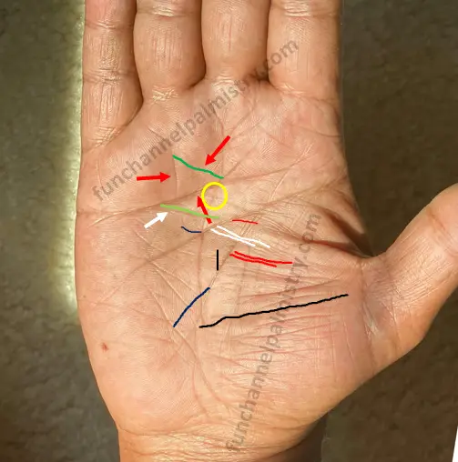 Triangle on heart line below mount of Sun