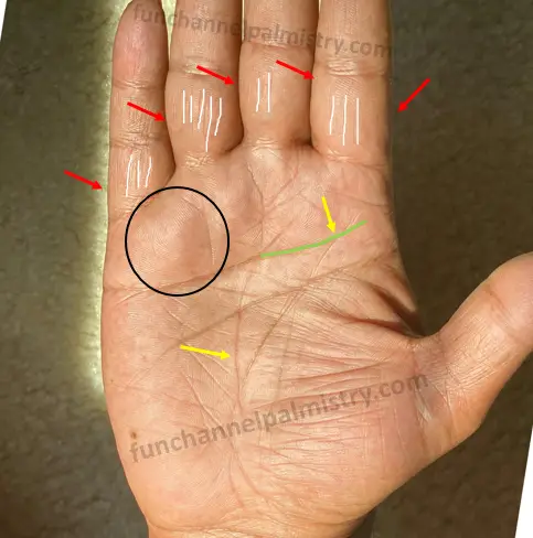 vertical lines on fingers