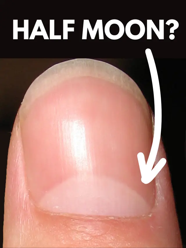 Do You Have Half Moon On Your Nails?