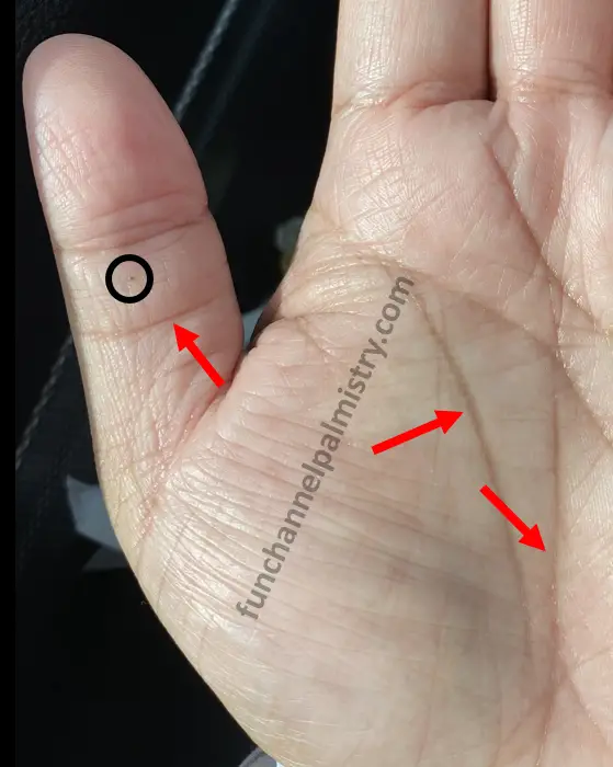 black spot on thumb in palmistry